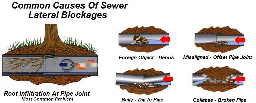 Common causes of sewer lateral blockages: root infiltration at a pipe joint, debris, offset joint, belly and broken pipe